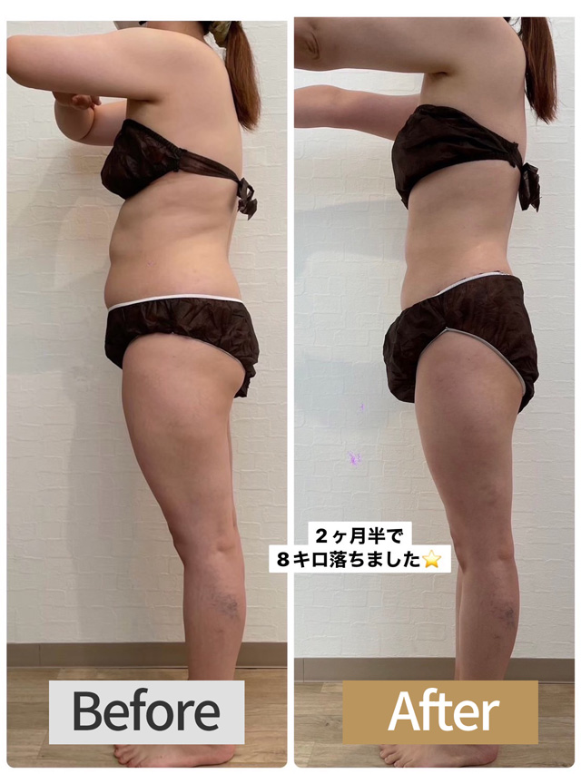 瘦身ダイエットビフォーアフター